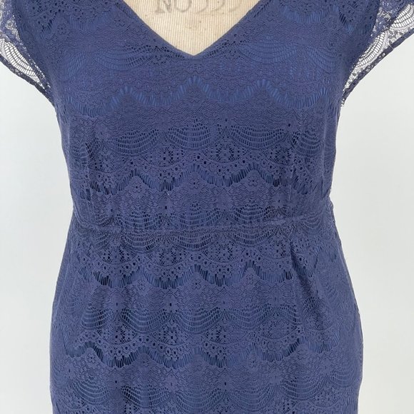 Fossil Penny Lace Dress M Bohemian Cap Sleeve V-Neck Elastic Waist Scallop Navy - Picture 3 of 11